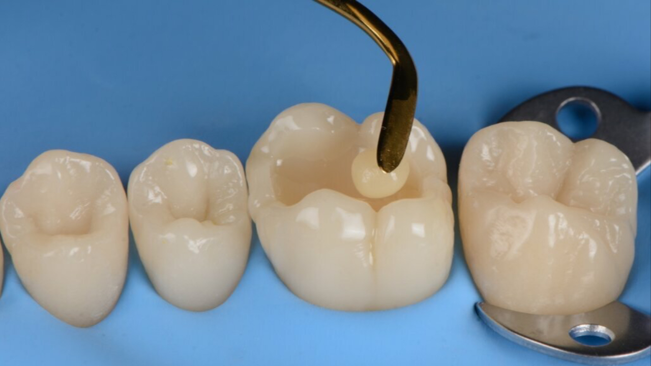 Biomimetic Dentistry