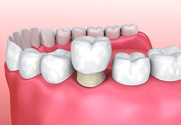 Blog Post Image