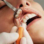 Scaling: Does It Weaken Your Teeth or Strengthen Your Smile?